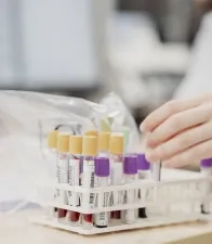Test rapides biologie