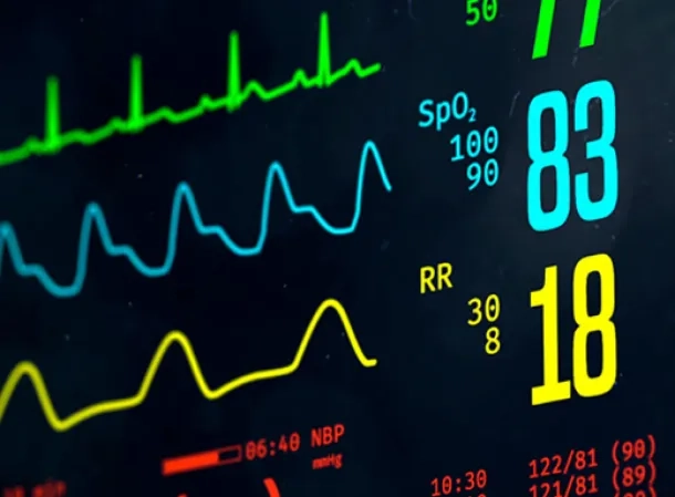 M_1908_ibm_monitoring_1