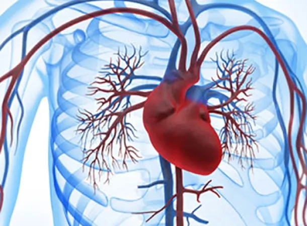 M_2718_IBM_ECMO_CPIA_apherese_1