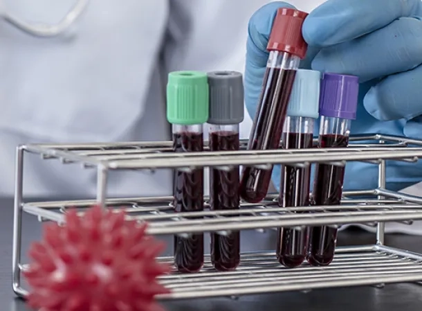 M_2849_Biologie_Horiba_1