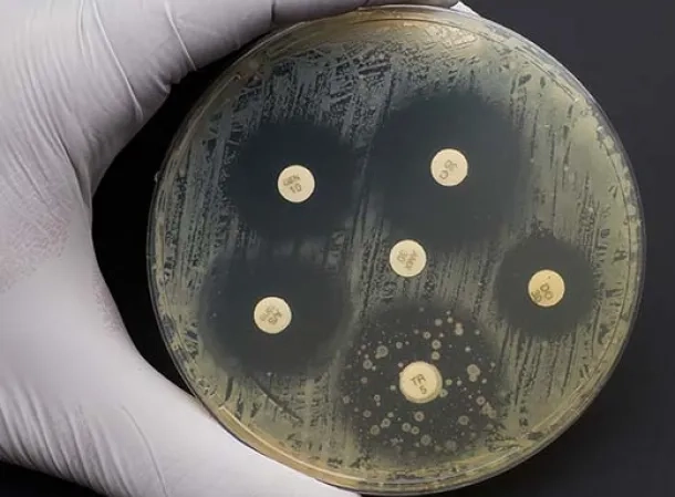 M_2870_FM_Biologie_Antiobiogramme_1