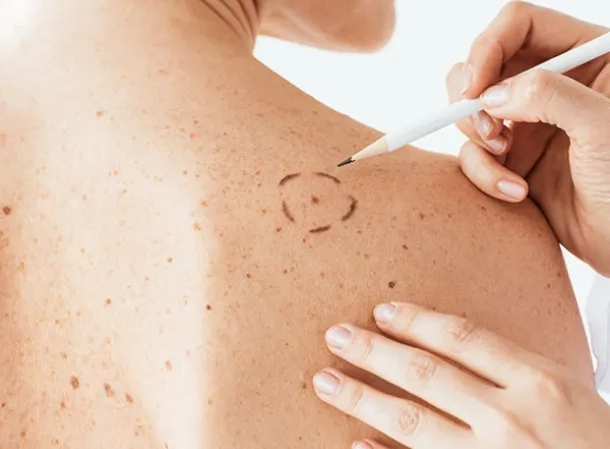 Explorations fonctionnelles dermatologie