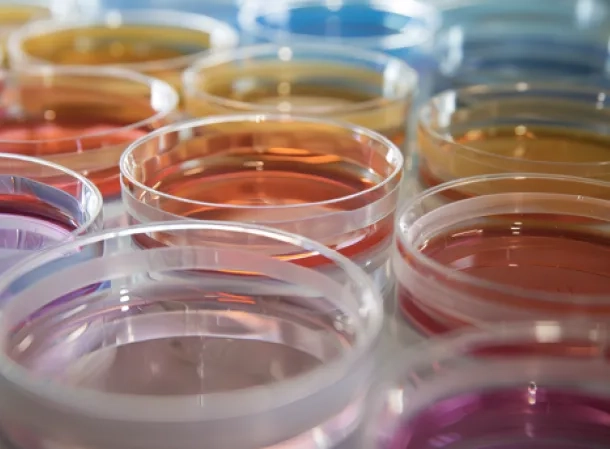 ANalyse microbiologique restauration