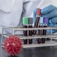 M_2849_Biologie_Horiba_1
