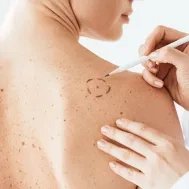 Explorations fonctionnelles dermatologie