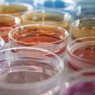 ANalyse microbiologique restauration
